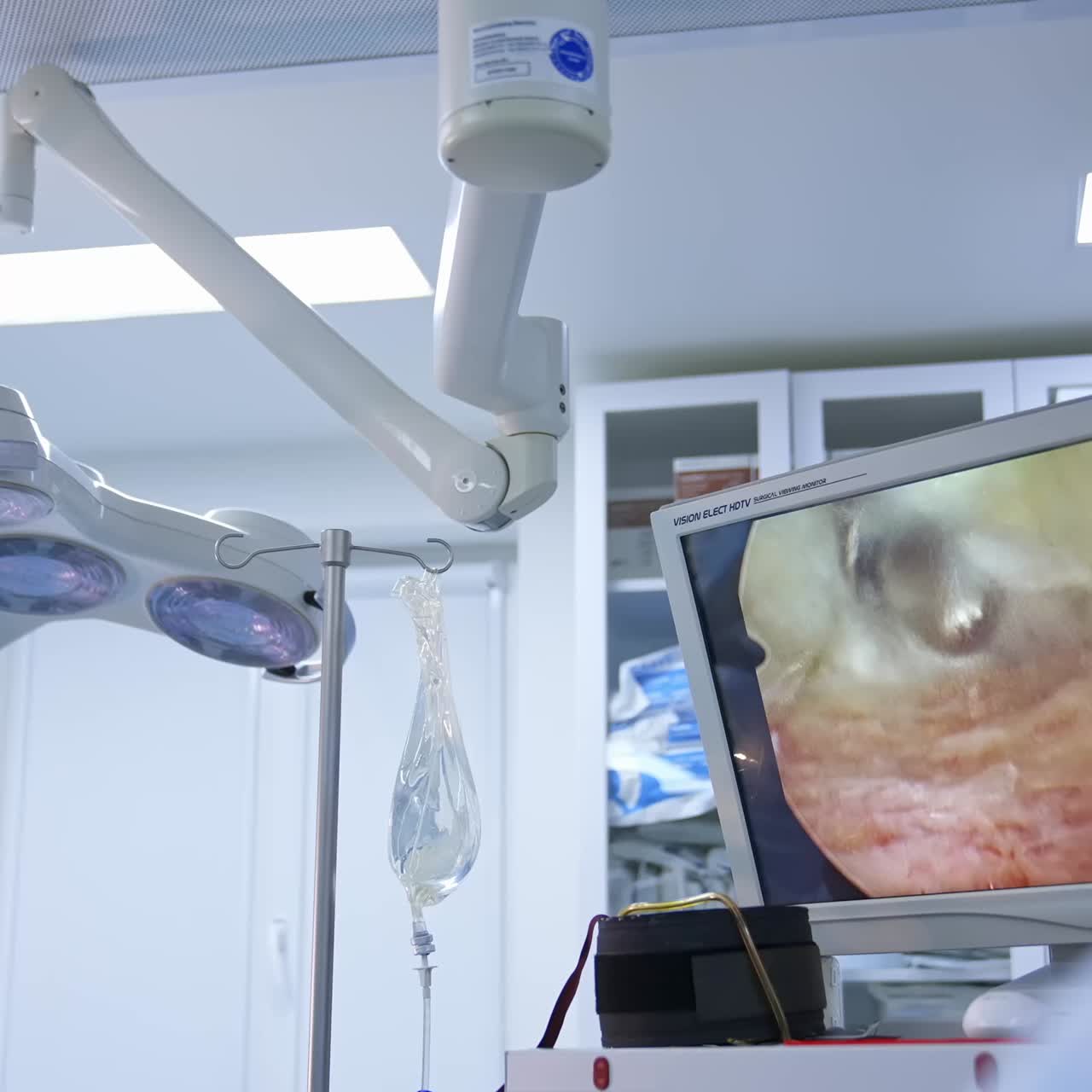 Professional surgeon performing operation. Group of medical workers doing surgery in operating room