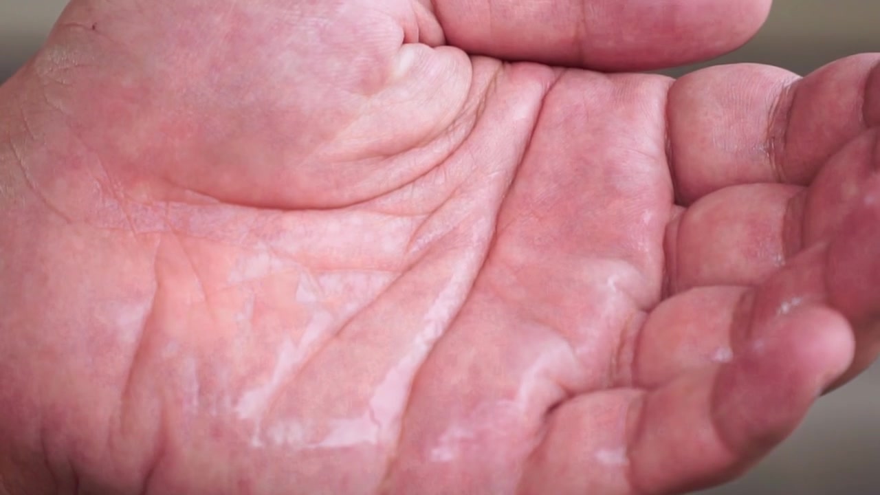 Disinfettante per mani spruzzato su una mano umana, primo piano, cura dell'igiene, protezione dai germi, salute e igiene personale.