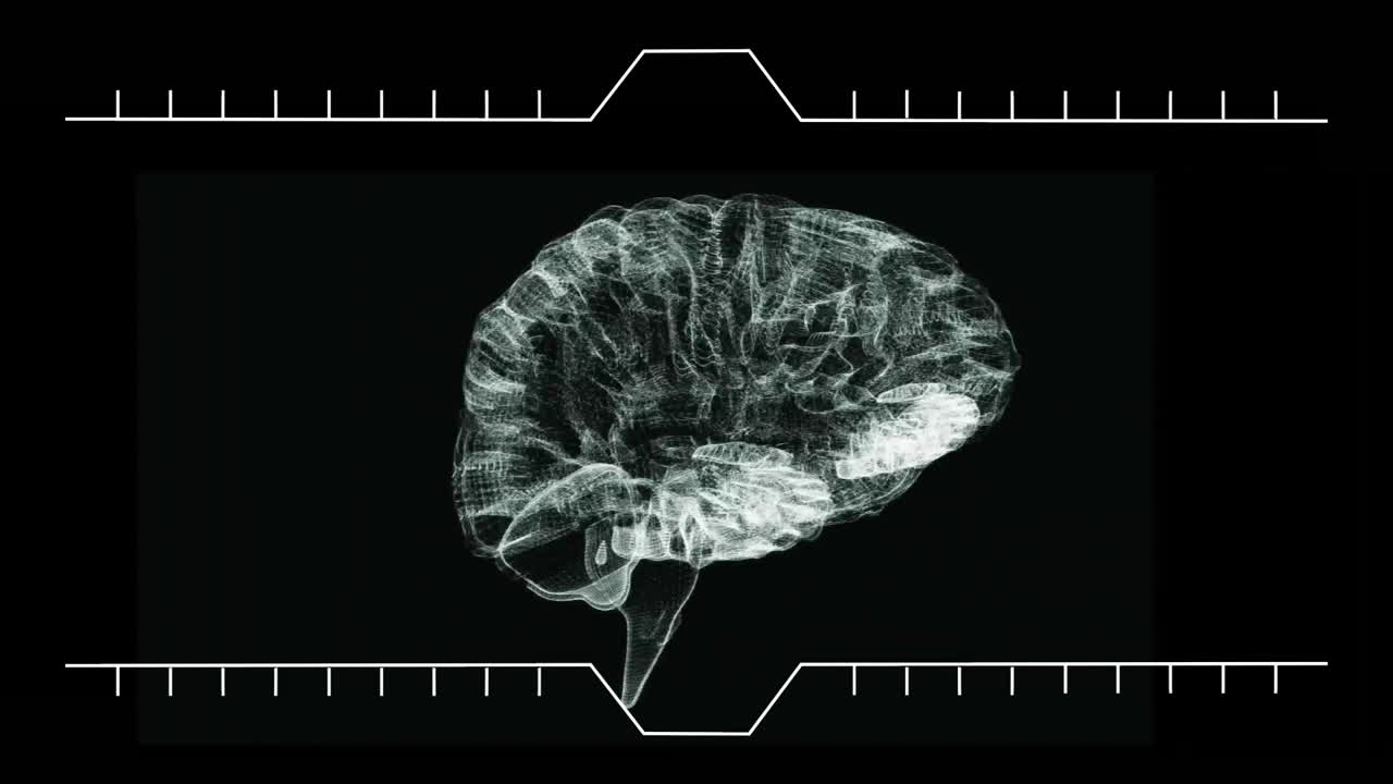 Animation of digital brain scan with grid overlay highlighting neural connections