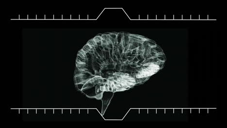 animation of digital brain scan with grid overlay highlighting neural connections