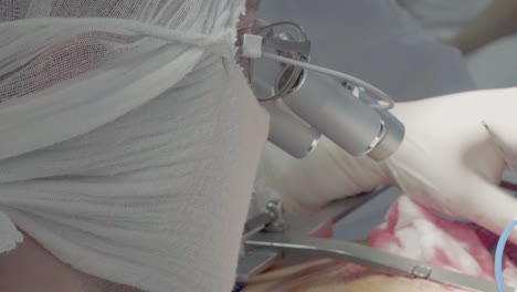 personal médico durante una operación cardíaca 5 de cerca