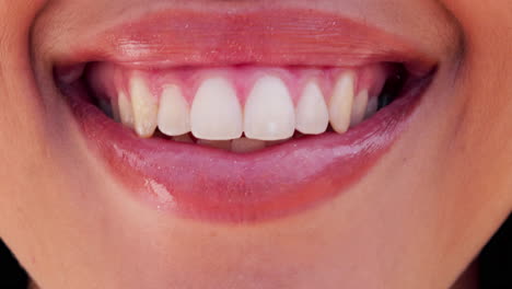 mujer, labios y dientes blanqueados con revestimientos