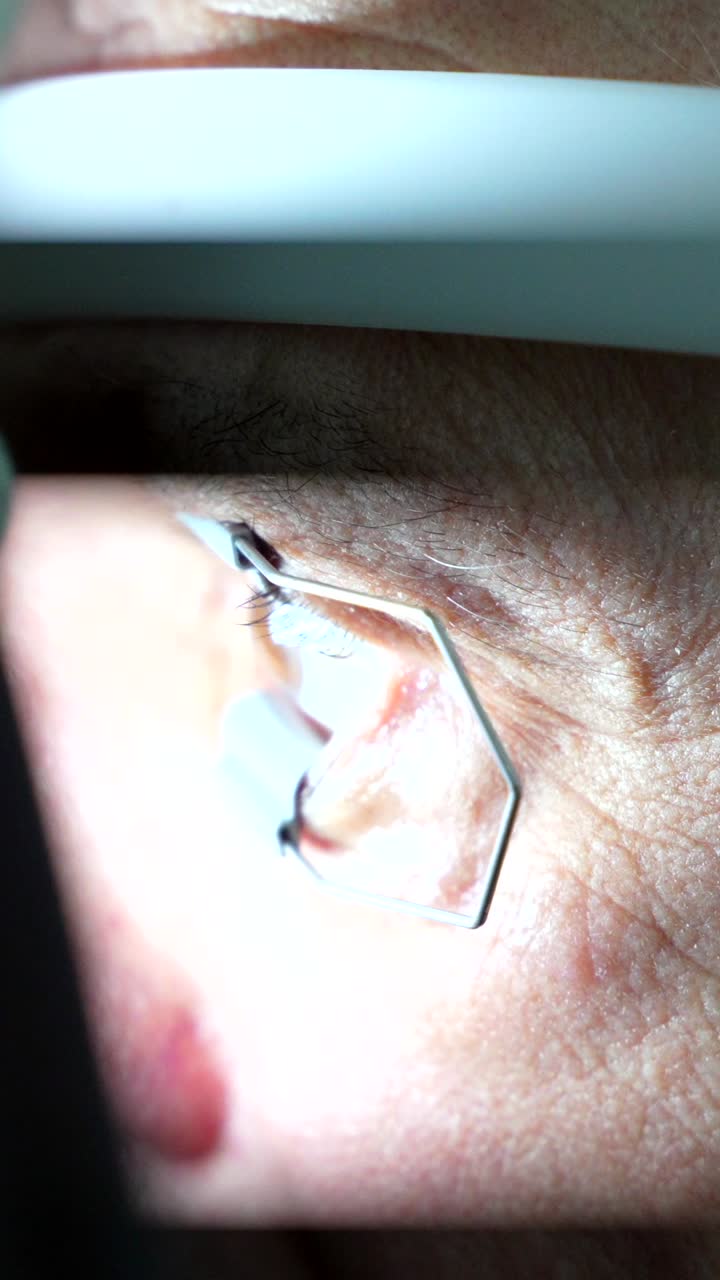 Eye Examination Close-Up