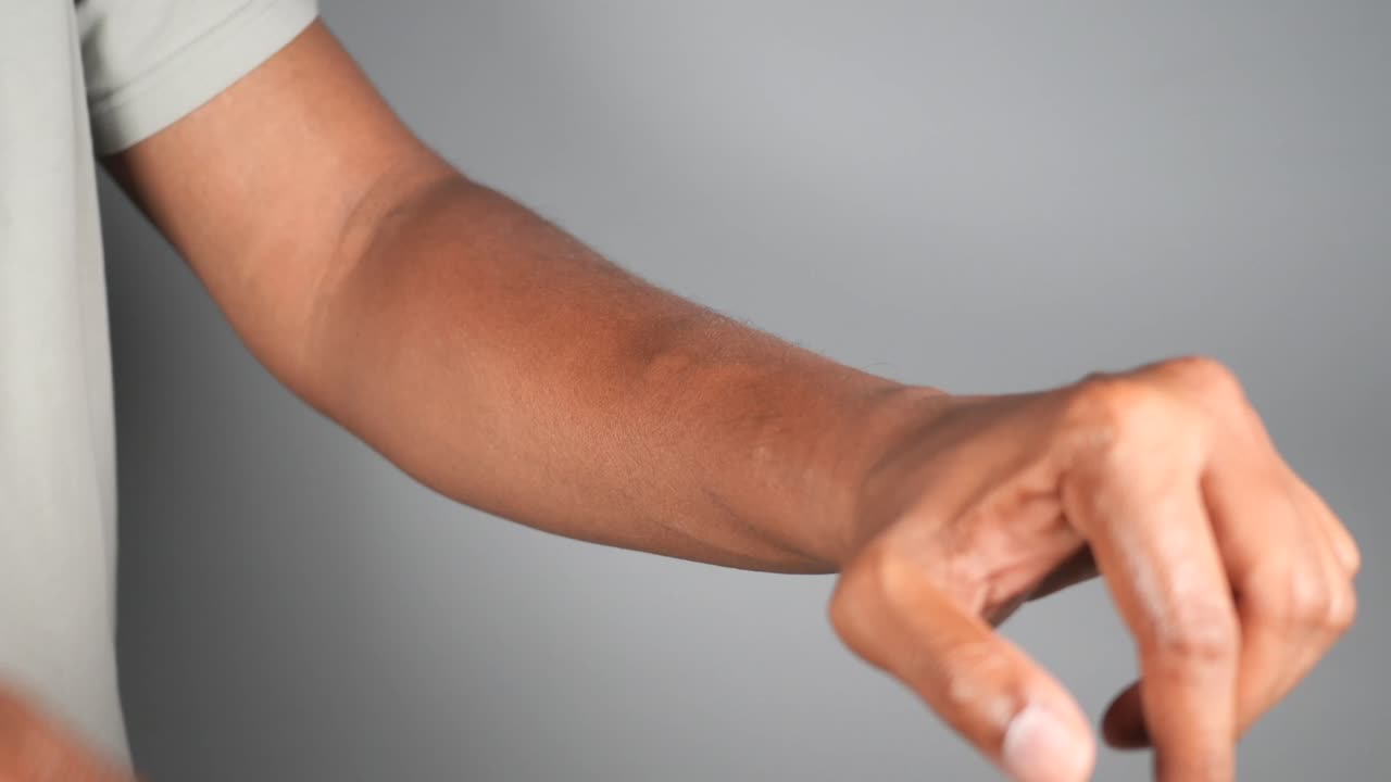 Rascarse el brazo