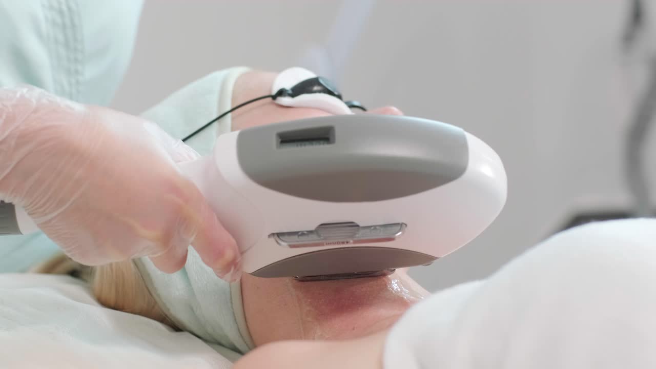 엘로스 피부 재생 절차: 냉각 젤과 함께 여성