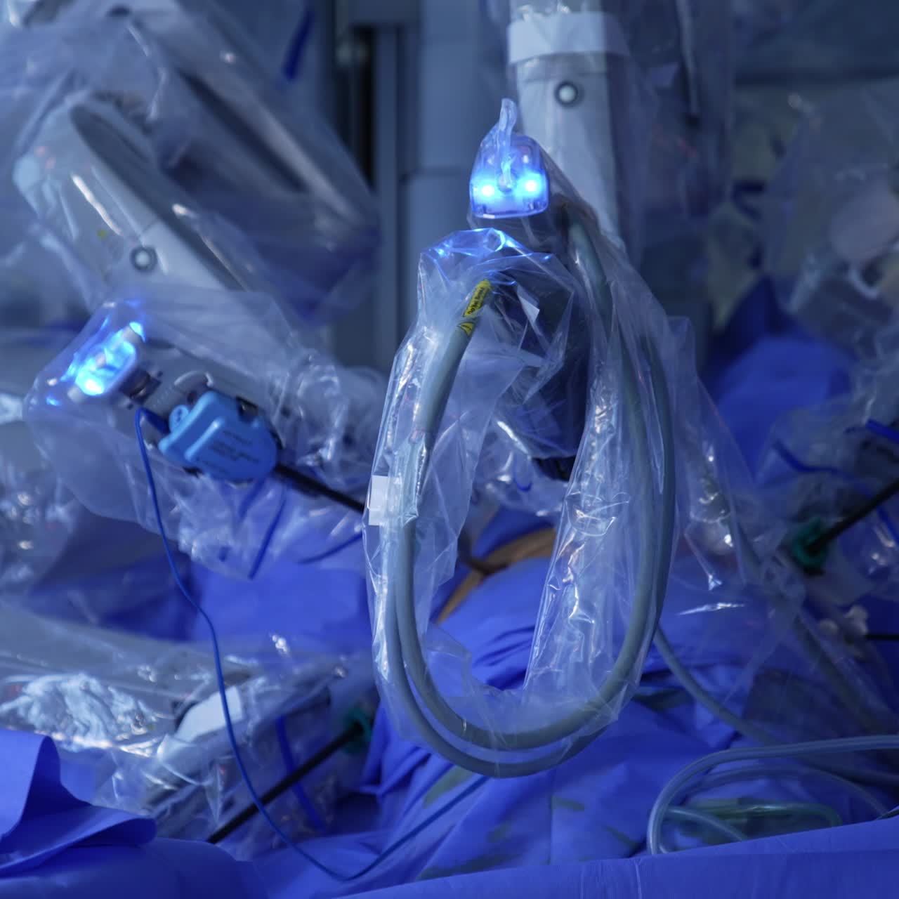 Manipulator arms covered in plastic moving slowly performing surgery. Robotic equipment doing surgical operation in cooperation with human doctors
