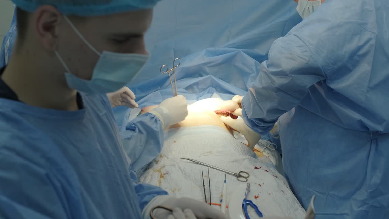Aumento del seno sotto la guida del team di chirurghi in sala operatoria chirurgica