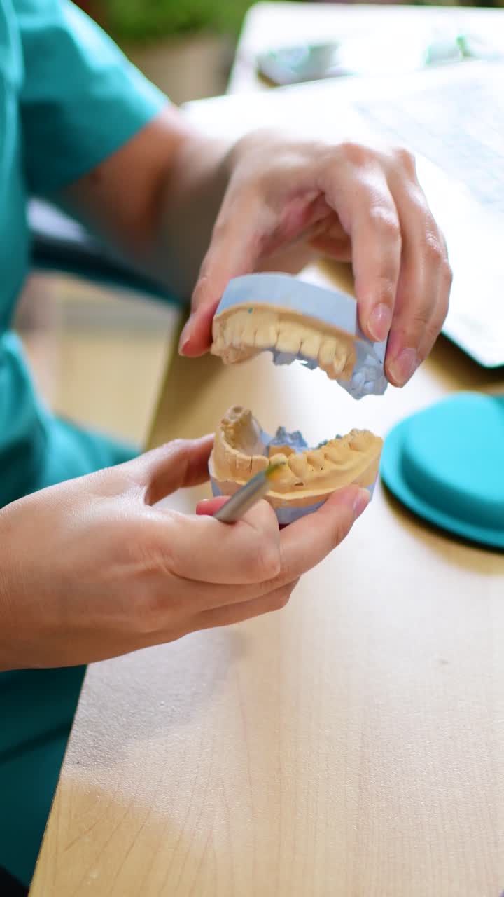 Dentist hand holding of gypsum jaw model of teeth.
