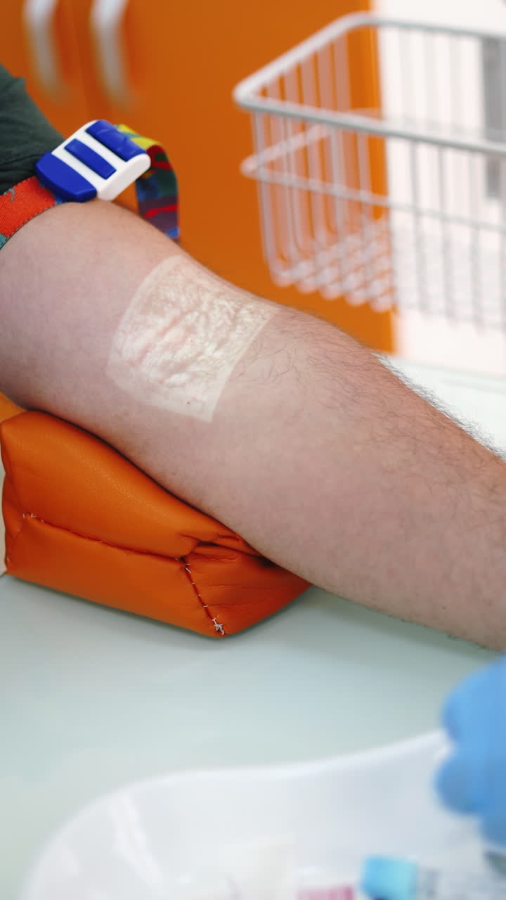 Close up process of taking blood. Process of blood sampling from the vein for examination. Vertical video