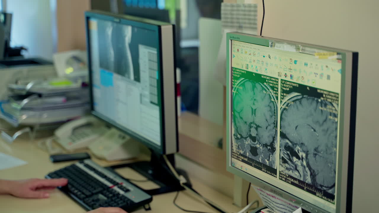 X-ray scanner on computer. Operating room with x-ray medical scan