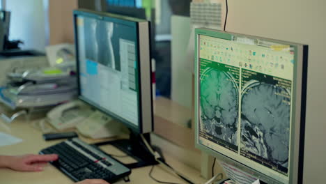 X-ray scanner on computer. Operating room with x-ray medical scan