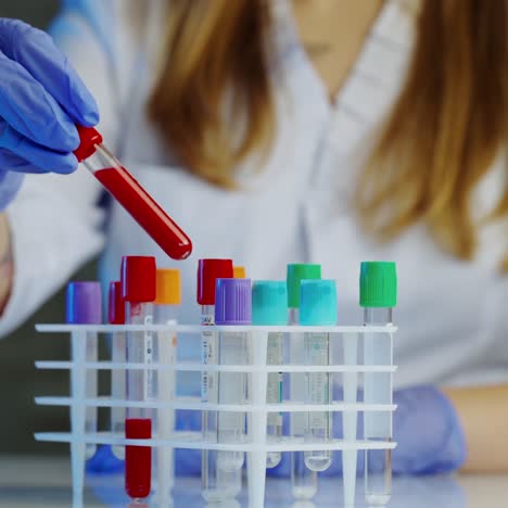 blood sample tubes