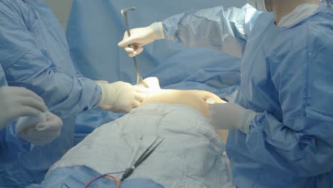 breast augmentation under the guidance surgeons team in surgical operating room