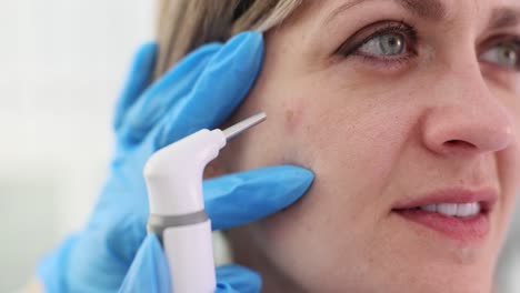 dermatological skin treatment with medical device