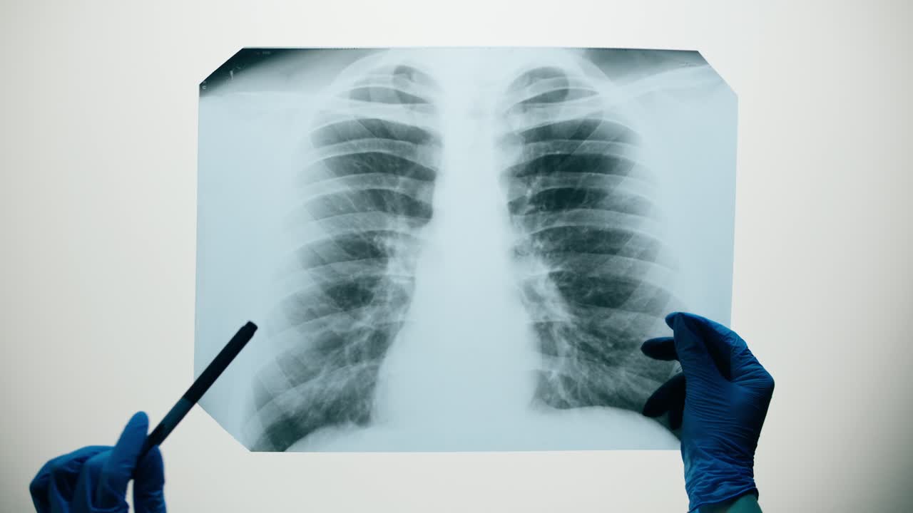 Professionista medico che analizza una lastra radiografica del torace umano.