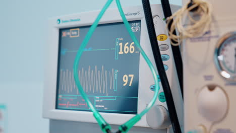gloved hand of a medic pressing the buttons on the screen of medical equipment. lung ventilator monitor closeup.