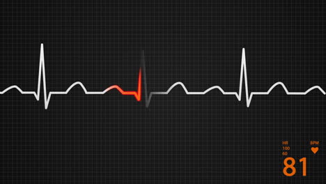 animation of a schematic diagram of normal sinus rhythm for a human heart seen on electrocardiograph screen. blue highlight on a bright background. perfect for any medical-related purposes.