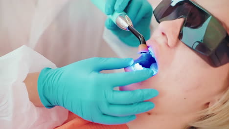 procedimiento de blanqueo de dientes en el dentista