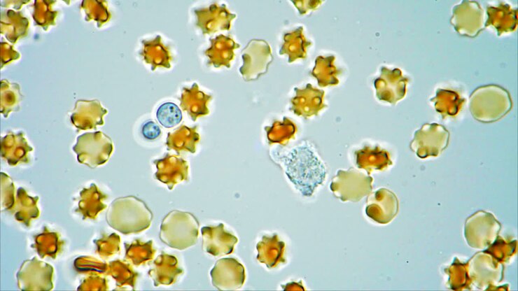 Microscopic View of Crenated Red Blood Cells and Other Cells