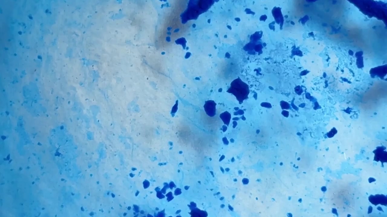 Particelle di sostanza blu astratte.