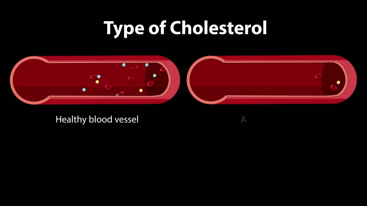 건강한 혈관과 동맥경화 혈관을 보여주는 애니메이션