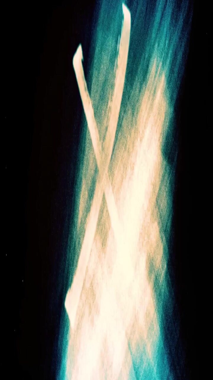 Simbolo X Luminoso Astratto che Appare su Sfondo Scuro