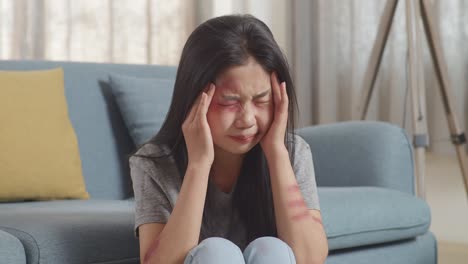 close up of young asian woman victim of violence with bruise on body being stressed and shaking her head having a headache while sitting at home