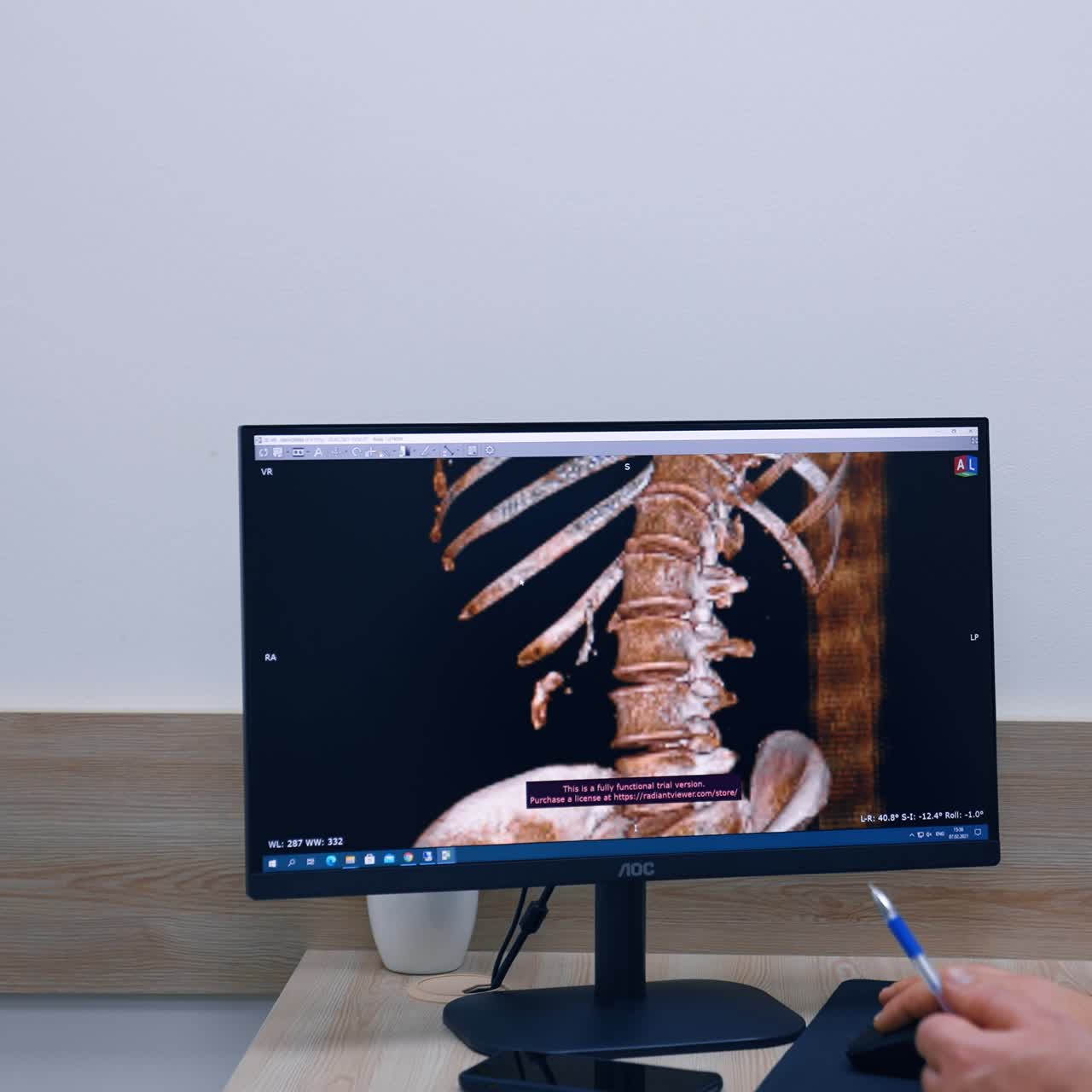 Doctor and patients are focused on the skeleton scan on computer screen. Health consultation at hospital