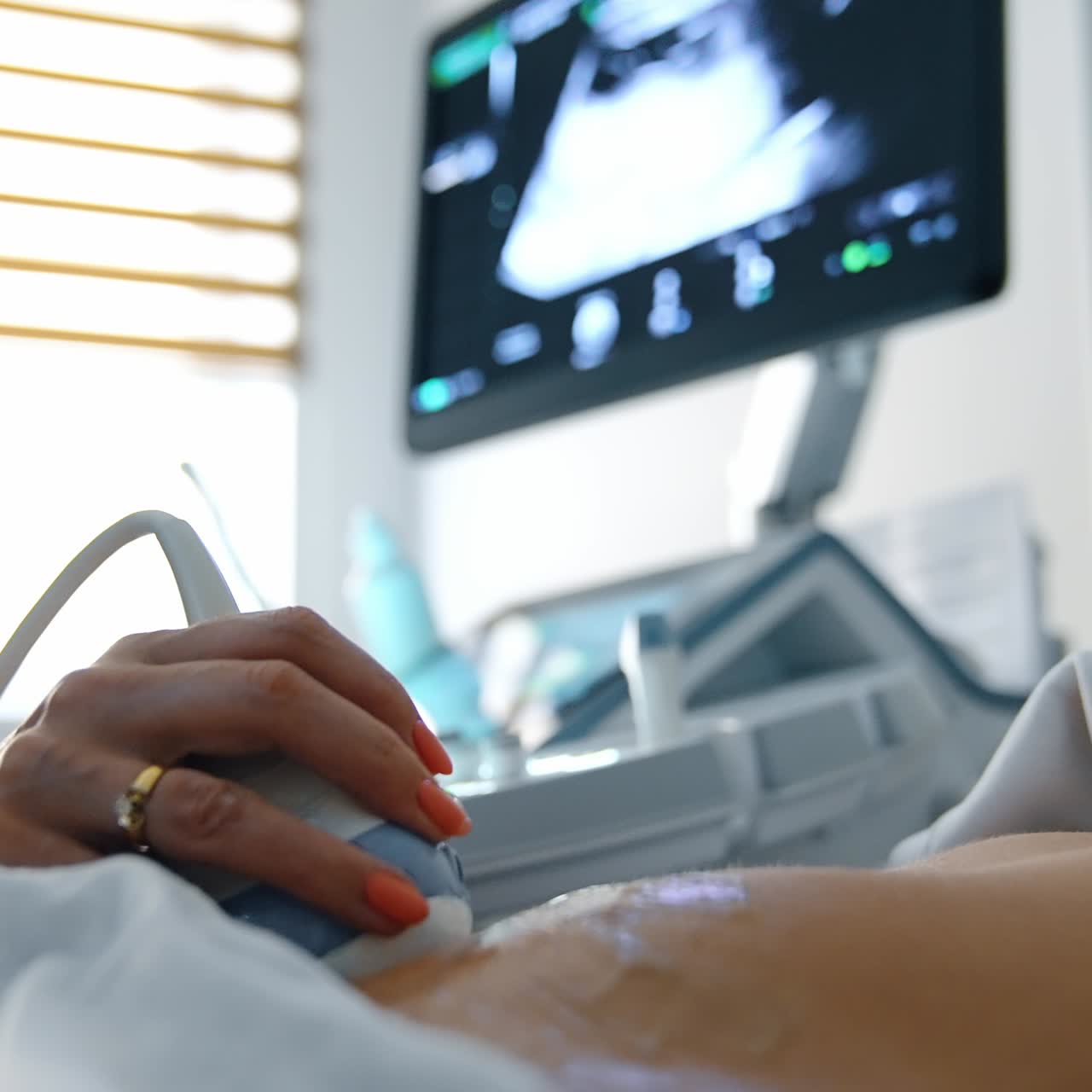 Doctor moving the ultrasound sensor by the gelled belly of pregnant patient. Close up. Monitor of machine at backdrop in blur
