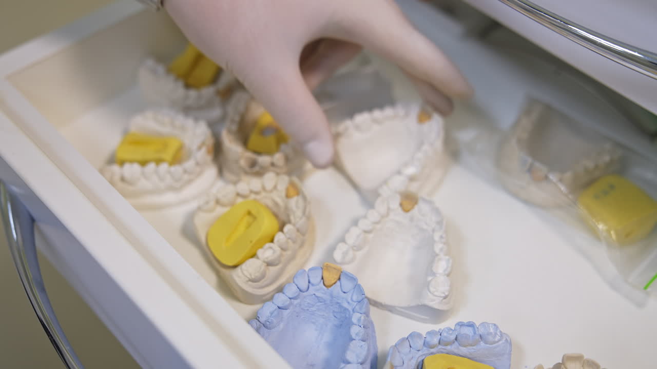 Gloved hand with wrist watch opens a drawer with plaster models of teeth. Person picks one model, puts it back and takes another one, then closes the drawer. Close up.