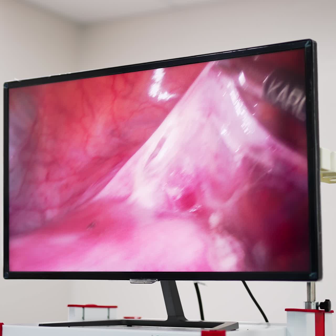 Up-to-date equipment in the operational theatre. Big monitor showing the inner organ operated by modern tools