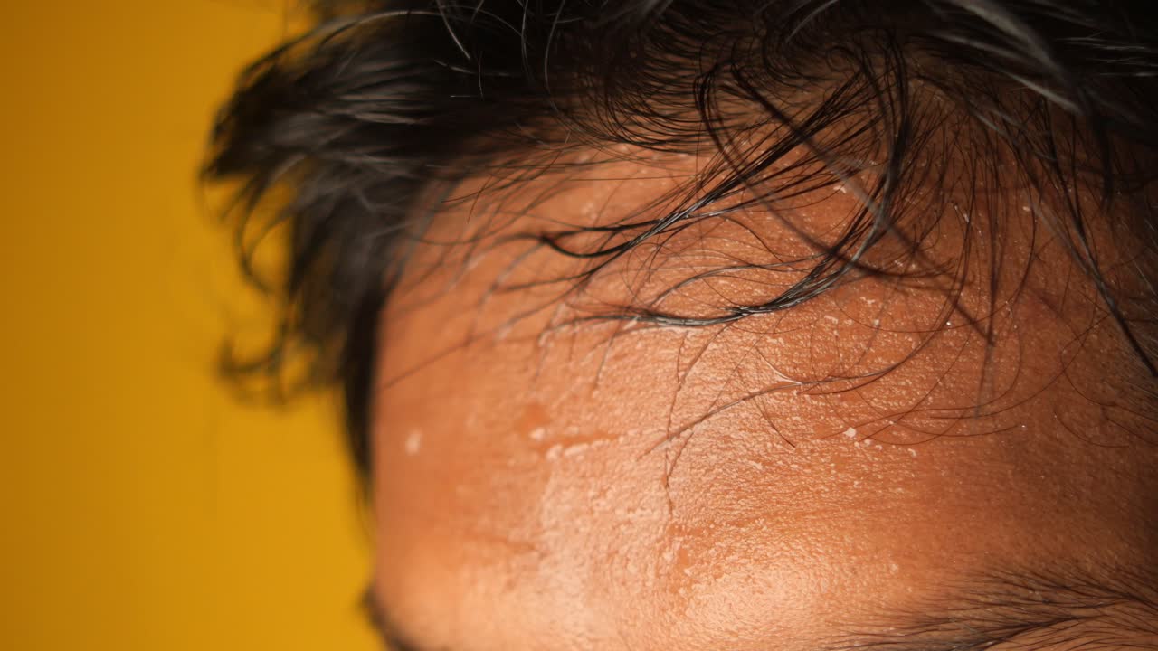 을 흘리는 남자 이마의 클로즈업