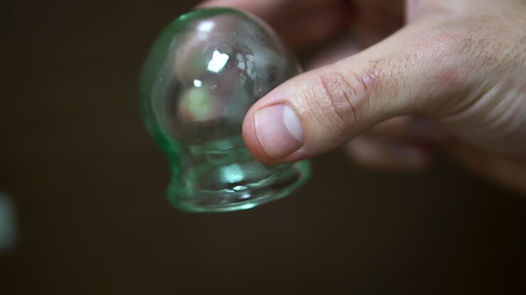 Cupping Therapy Process