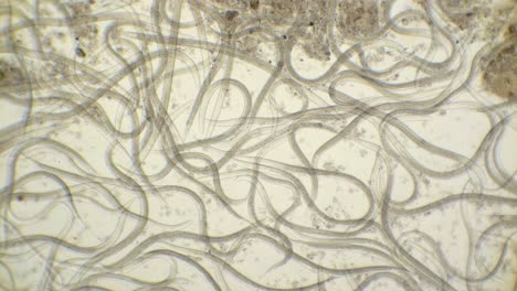 una vista microscópica de nematodos de gusanos redondos, steinernema, con una ampliación de 100 veces