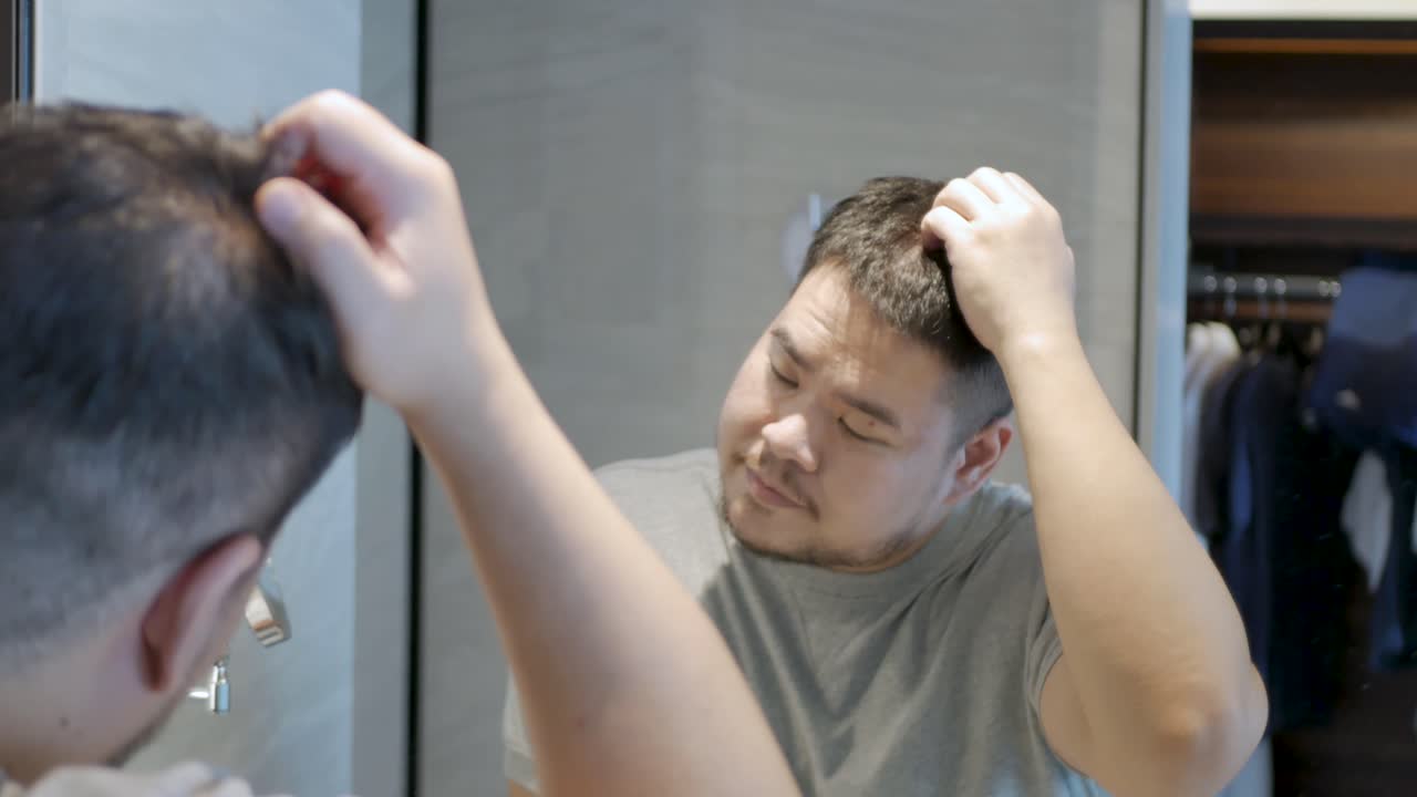 거울에 비친 머리털, 탈모로 고통받는 대머리