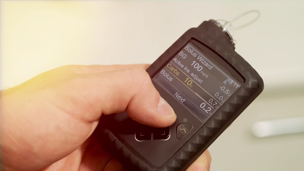 hombre diabético con una bomba de insulina conectada en su abdomen y sosteniendo la bomba de insulina en sus manos. concepto de diabetes.