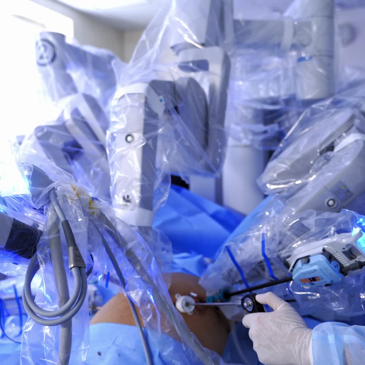 Microsurgery by medical robot. Doctor near the surgical arms of futuristic robotic machine performing a surgery to a patient. Hi-tech technology in medicine.