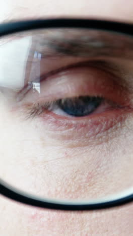 close-up of patient eye