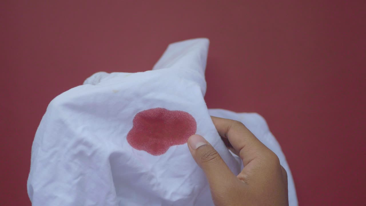 cómo quitar las manchas de sangre de las camisas blancas