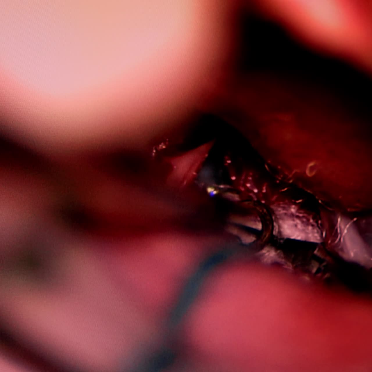Metal tools work in the inner organ during surgery. Part of the picture on the screen in operational room. Close up