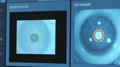 Ophthalmic surgery. View on the screen of medical monitor in operating room. Lasik