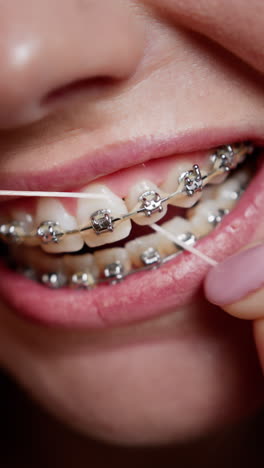mulher usando fio dental com aparelhos dentários