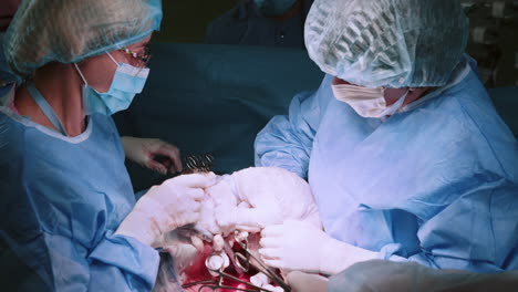 cesarean section delivery