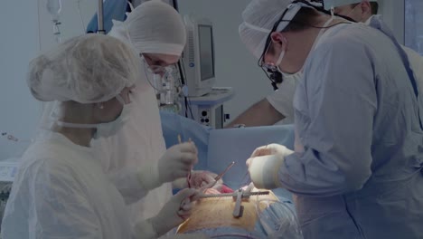 medical staff of the operating unit do heart surgery nurse assists in performing the operation