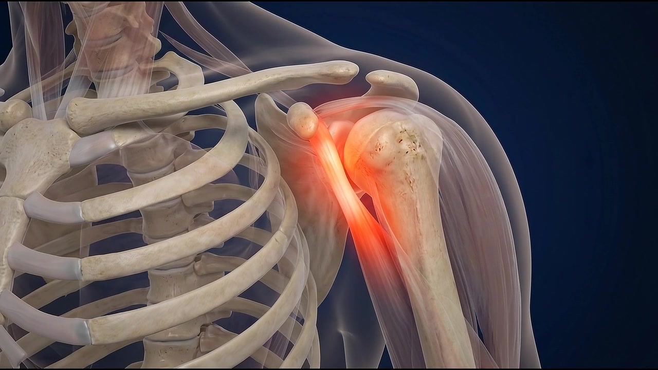 Visualizzazione scientifica del cervello umano che evidenzia il dolore