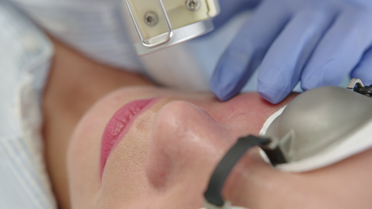 Woman undergoing laser skin treatment