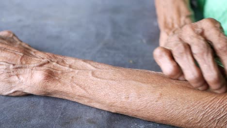 elderly person scratching their arm