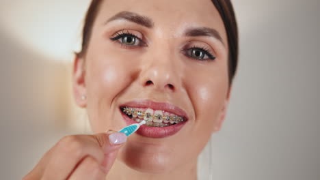 mujer limpiando los dientes con aparatos dentales