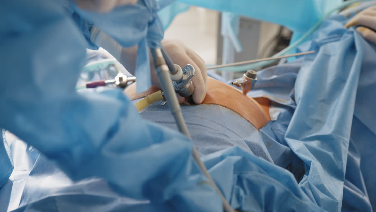 cirugía abdominal laparoscópica