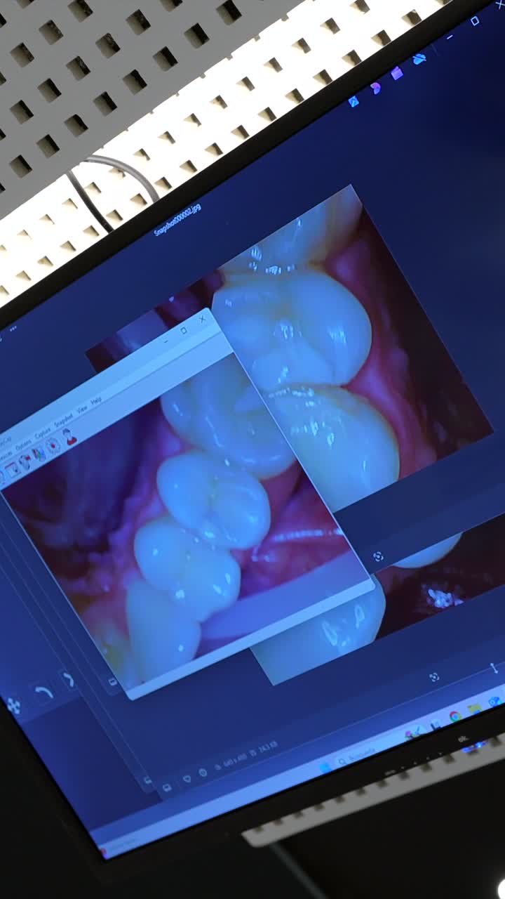 Dental Restorations on a Computer Screen